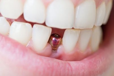 dantys728.jpg