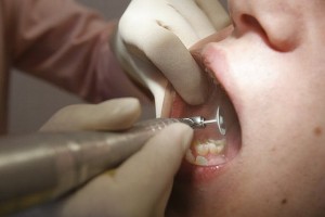 Širvintų rajono gyventojų dantų protezavimui skiriama vos penki tūkstančiai litų